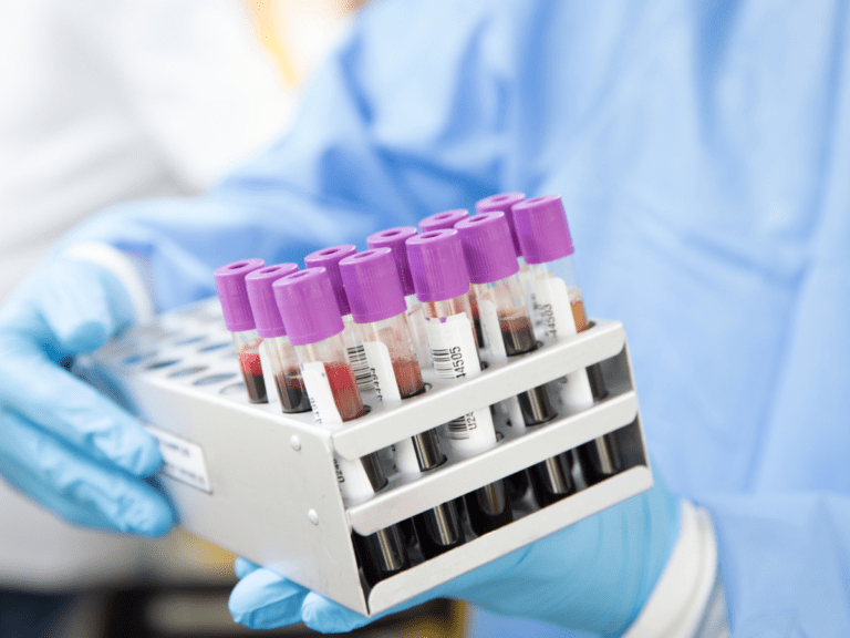 Aminosäuren Blutprobe