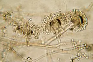 Aspergillus oryzae